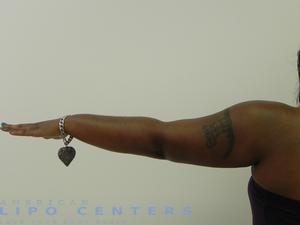 americanlipocenters_72.jpg